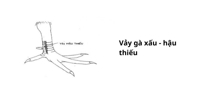Vảy hậu thiếu